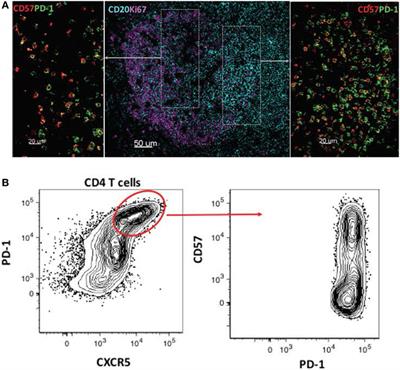 Visualizing the Immune System: Providing Key Insights into HIV/SIV Infections